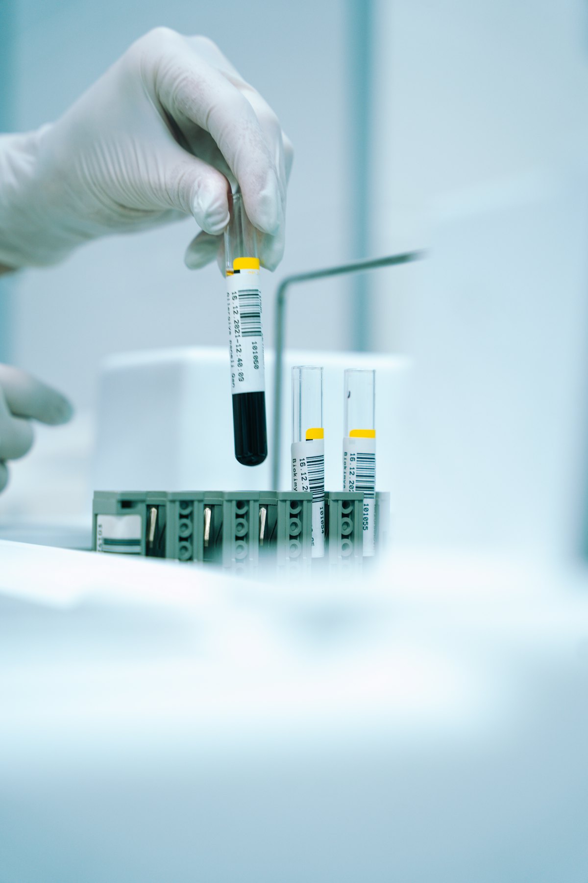 A gloved technician placing a vial of blood into a rack for centrifuge processing